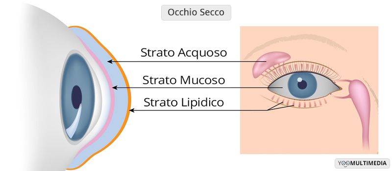 Diagnosi e trattamento dell'occhio secco Diagnosi e trattamento dell'occhio secco